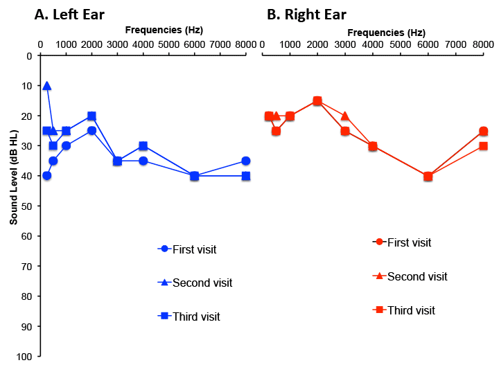 Positional Vertigo: Figure 2