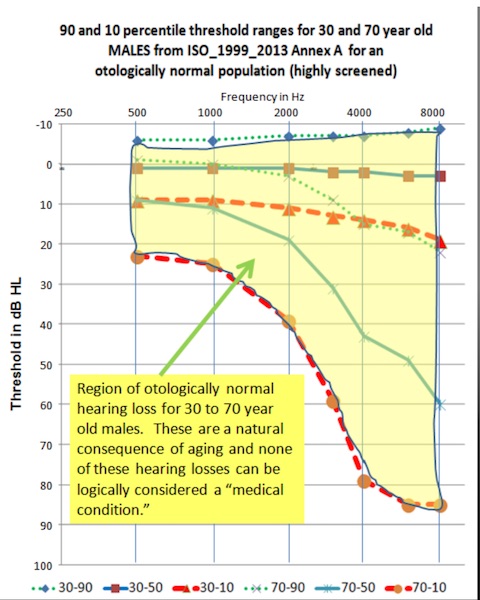 Killion-IOM-Slide Figure 1