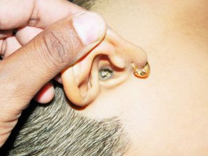 Ear_Wax