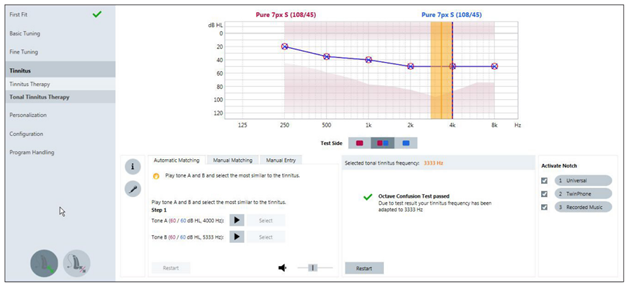 Total Tinnitus Therapy Fig 2