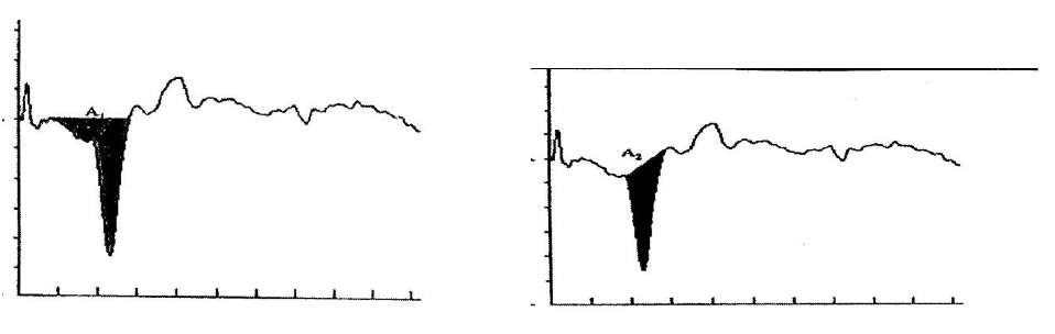 Figure 5_958