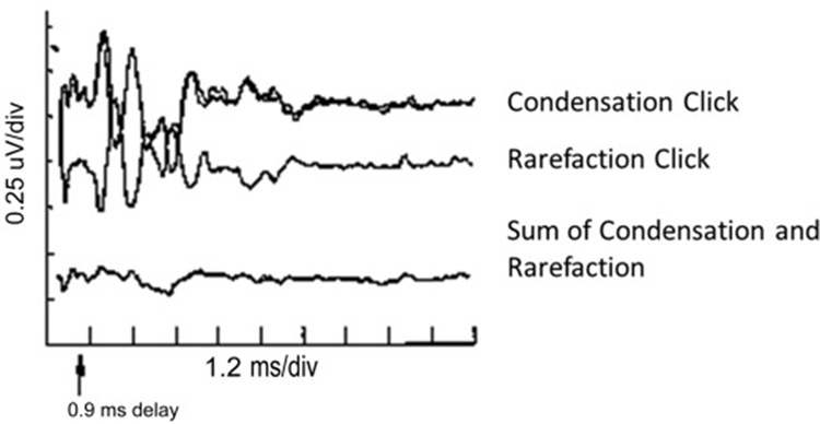 auditory neuropathy spectrum disorder