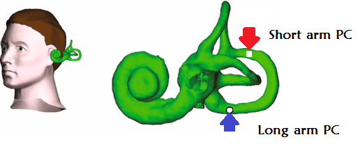 Striking the Right Balance – Posterior Canal BPPV Clinical Variation ...