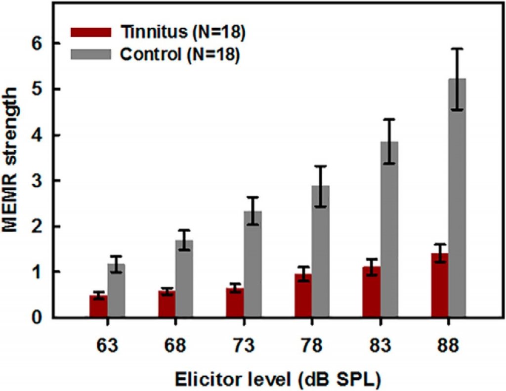 Tinnitus with a Normal Audiogram | Canadian Audiologist