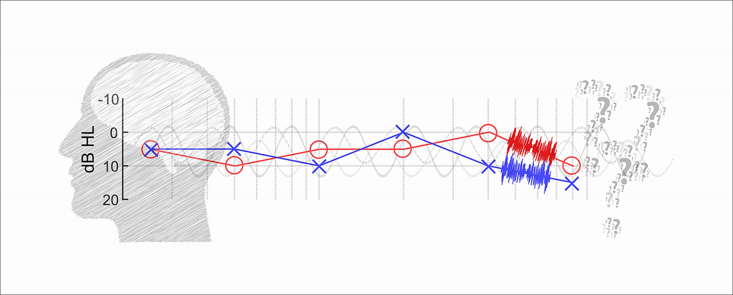 Low frequency tinnitus one on sale ear