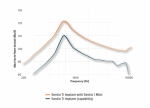Active Transcutaneous Alternative for Patients with Conductive Hearing ...